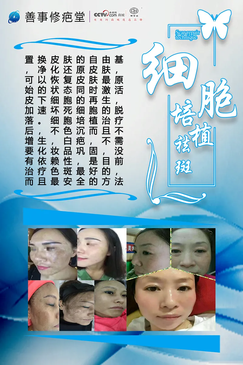 细胞培植祛斑