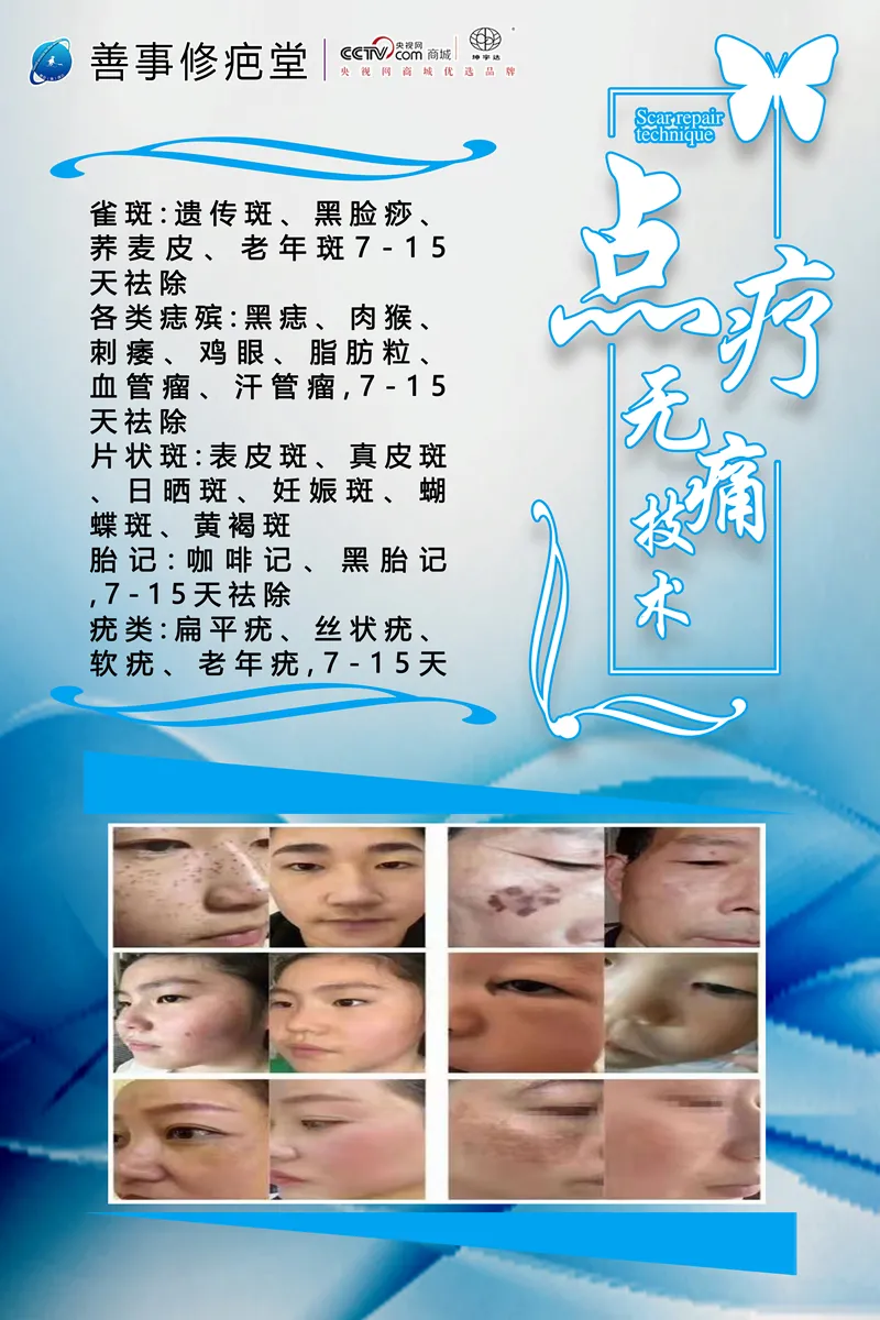 点疗无痛技术