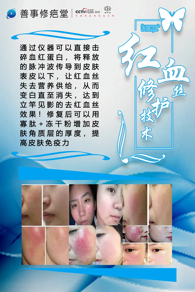 红血修护技术