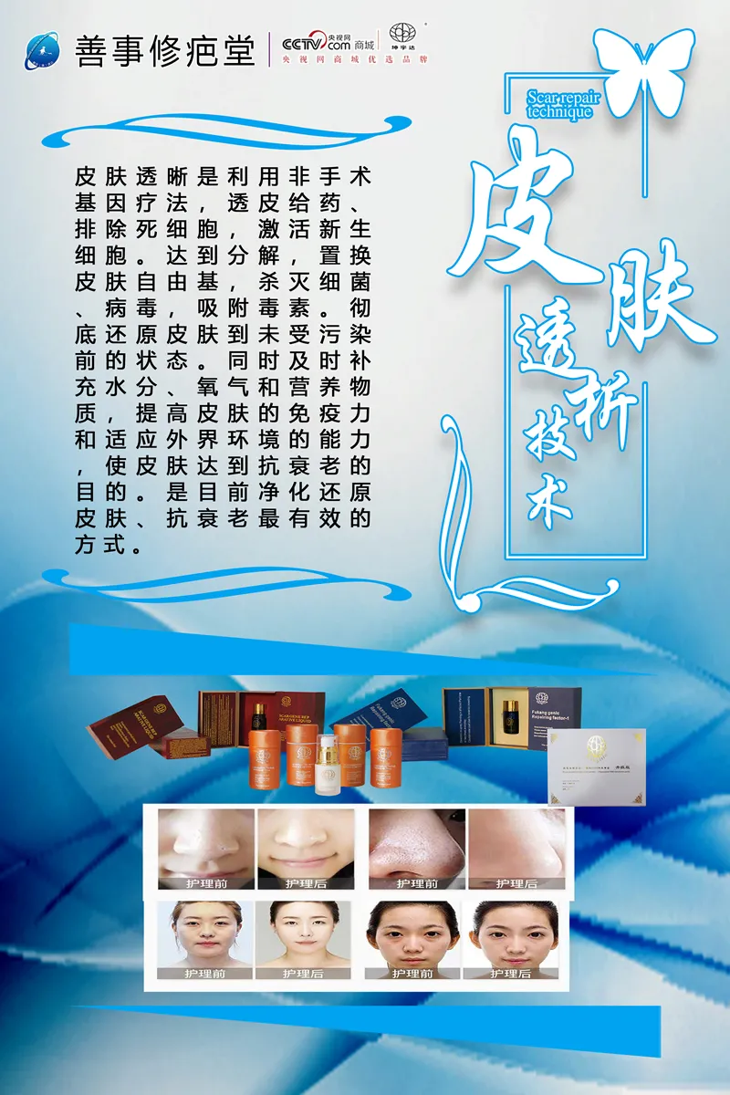 皮肤透析技术