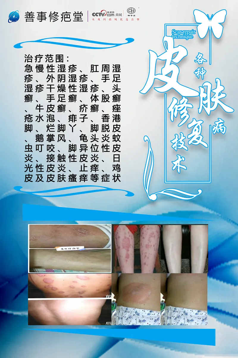 皮肤修复技术