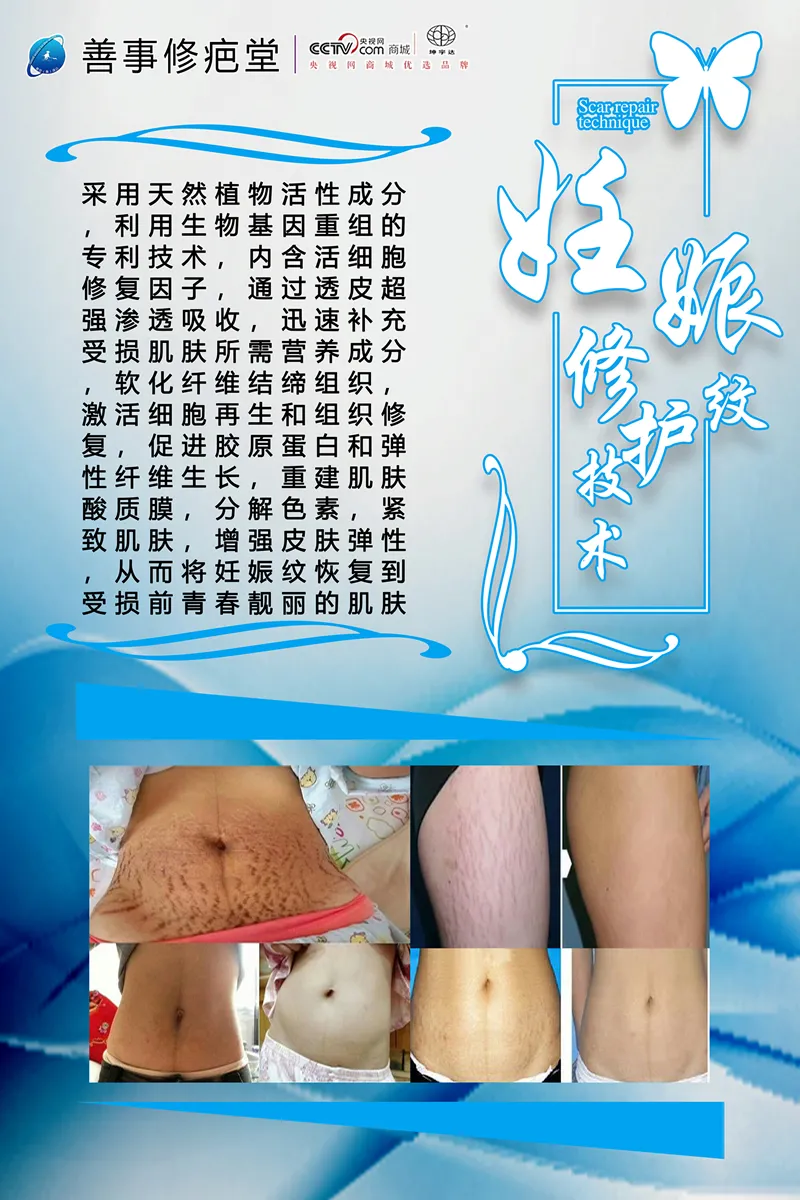 妊娠修护技术